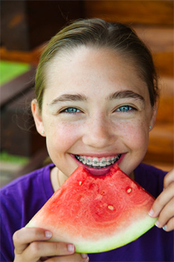 Easy To Eat Foods After Getting Your Braces Tightened - Blog - Sparkle Dental - foods-with-braces
