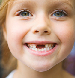 How Are You Going To Pull That Loose Tooth? - Blog - Sparkle Dental - pulling-loose-teeth