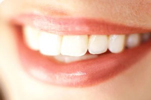 Dr. Monica Assad Answers Your Common Questions - Blog - Sparkle Dental - teeth-grinding