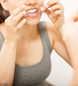 Cosmetic Dentists Finding Increase In Whitening Addiction Among Patients - Blog - Sparkle Dental - whitening-main